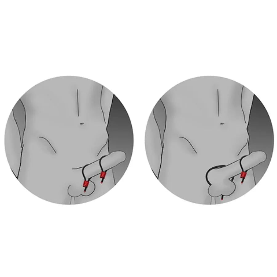 Anneaux péniens ElectraStim rouges en aluminium anodisé, réglables, pour stimulation électrique intense et prolongée.