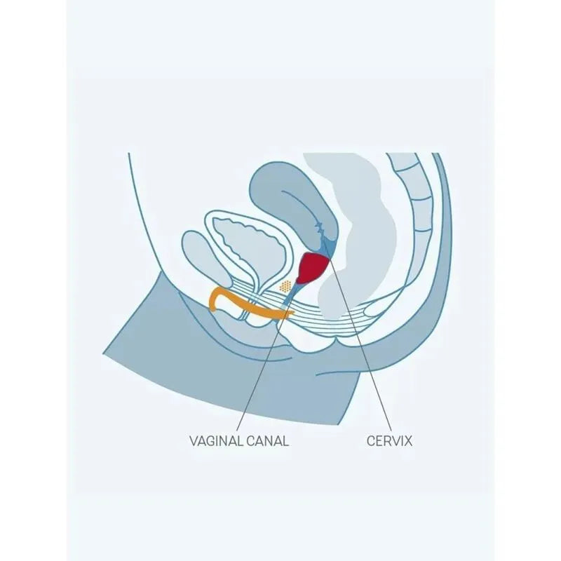 Coupe menstruelle silicone hypoallergénique taille A, ergonomique, réutilisable, insérée dans schéma anatomique féminin.